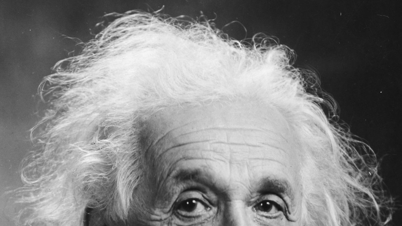 Ritka hajbetegség: egy kislánynak ugyanolyan a frizurája, mint Einsteinnek