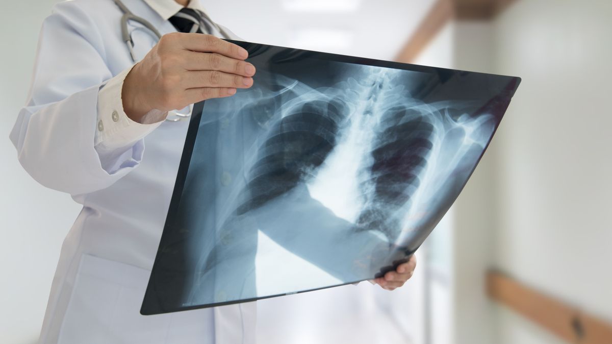 röntgen, vizsgálat