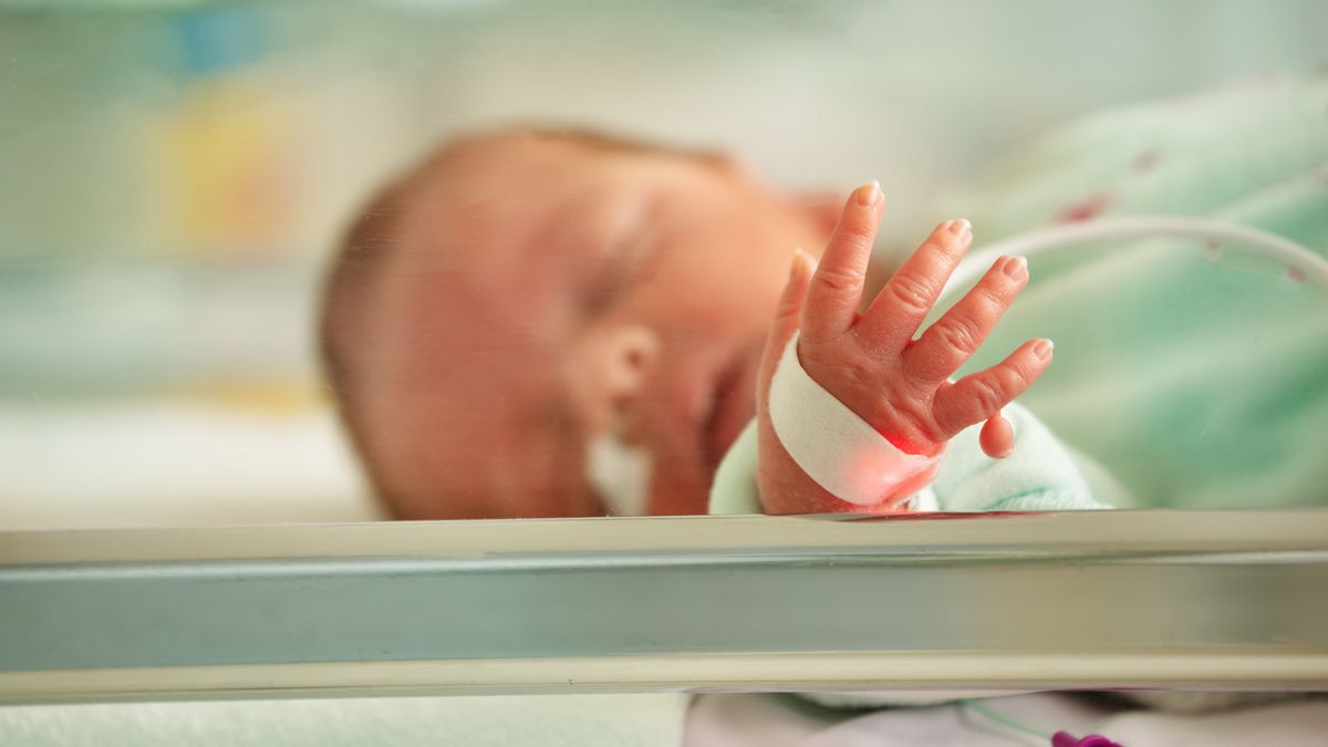 Supernumerary finger, Polydactyly case of newborn portrait